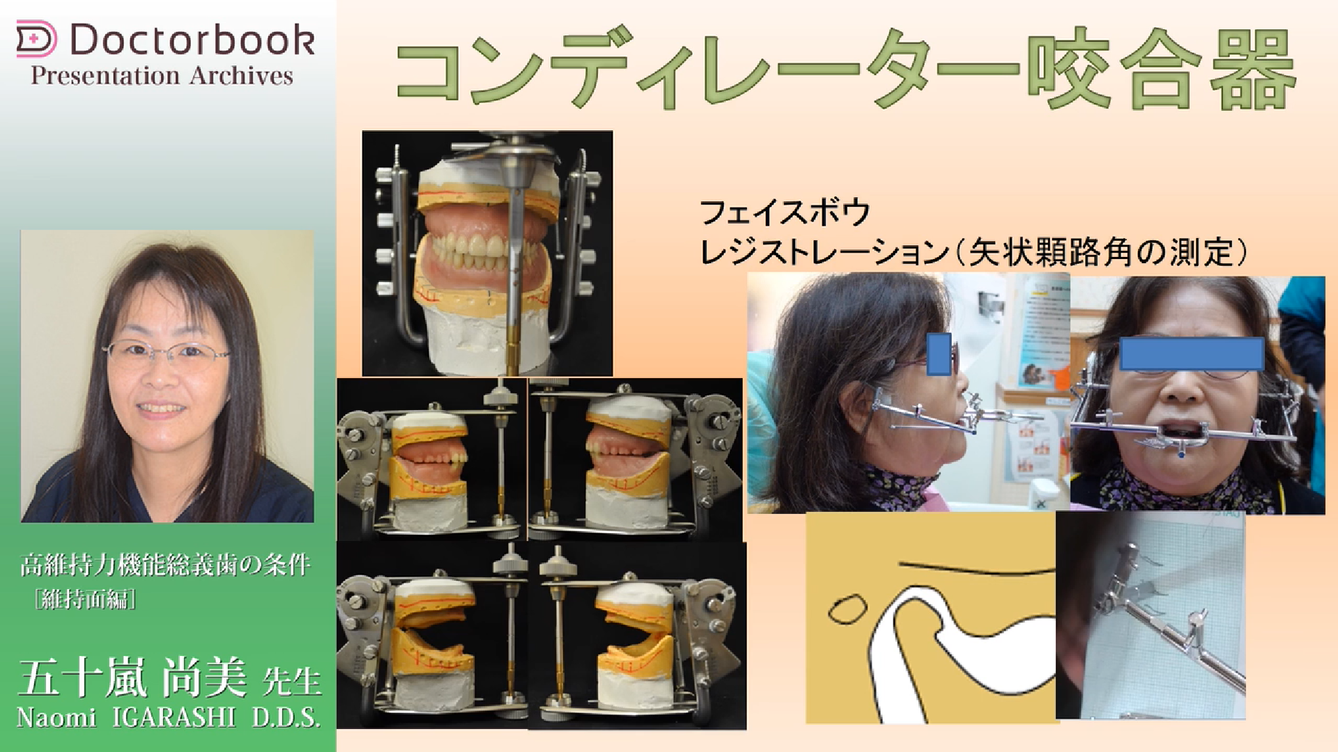 定番の冬ギフト これならできる明快総義歯作り : 効率化を目指し